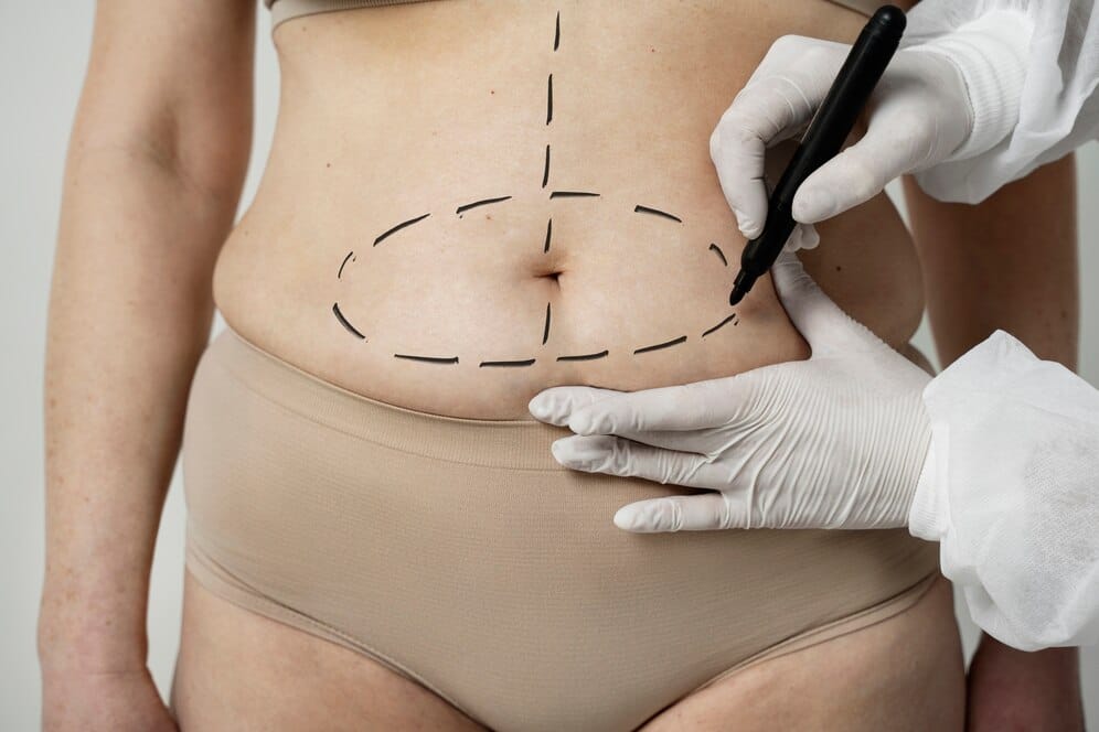 front view woman with marker traces belly 23 2149349968